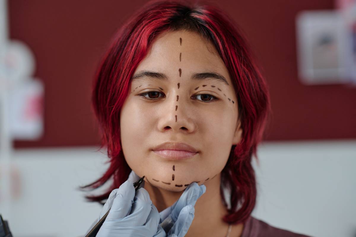 Face of pretty teenage girl with purple hair standing in front of camera while plastic surgeon in protective gloves drawing liftmark preparing for Harmonization Facial Surgery